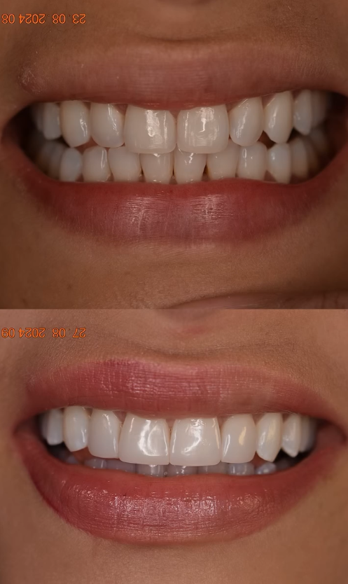Diseño de Sonrisa